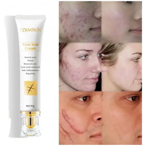 Pommade Anti Imperfections contre Cicatrices boutons tâches